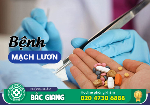 Bệnh mạch lươn hậu môn - Nguyên nhân, dấu hiệu và hướng điều trị tránh biến chứng