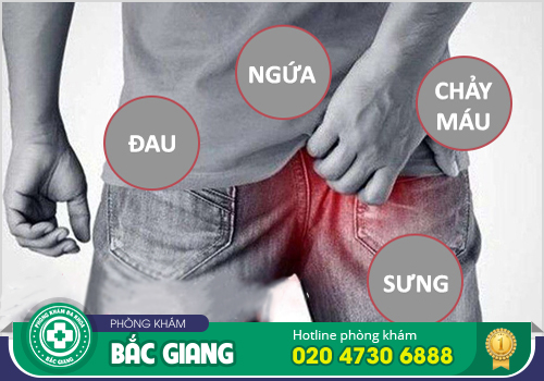 Những bệnh hậu môn cần xoá sổ ra khỏi cơ thể