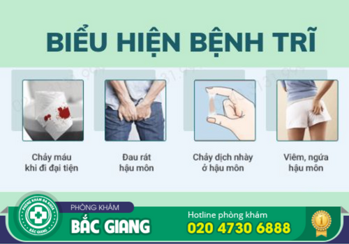 Triệu chứng của bệnh trĩ