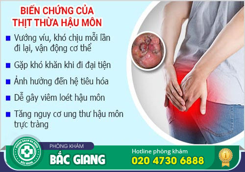 Cắt thịt thừa ở hậu môn bằng phương pháp nào hiệu quả?