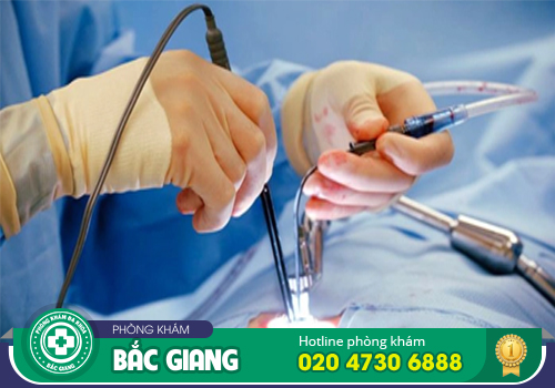 Các phương pháp cắt trĩ mới đang được nhiều bệnh viện, phòng khám áp dụng