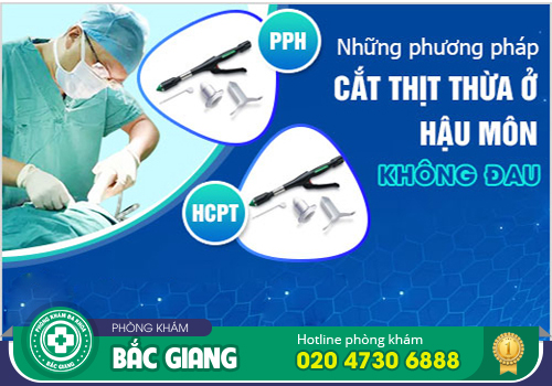 Có nên cắt da thừa hậu môn không?