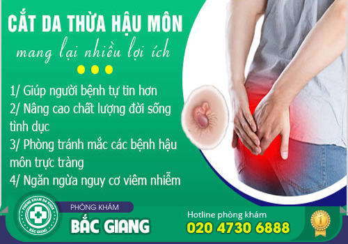 Có nên cắt da thừa hậu môn không?