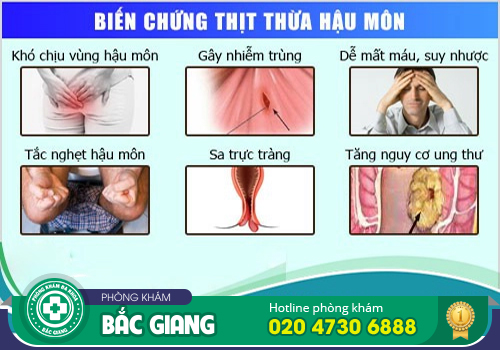 Có nên cắt da thừa hậu môn không?