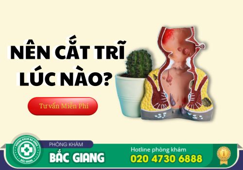 Có Nên Cắt Trĩ Không? Khi Nào Nên Đi Cắt Trĩ?