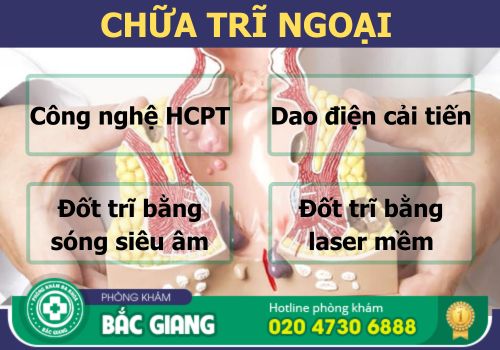 Chữa Trĩ Ngoại Đừng Đợi Tới Khi Bệnh Trở Nặng Mới Điều Trị