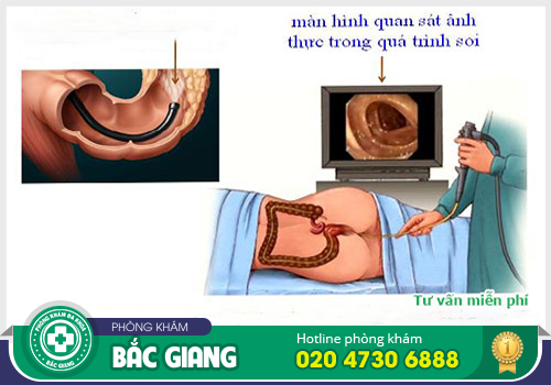 Kiểm tra hậu môn - Phát hiện sớm các bệnh liên quan tới trực tràng hậu môn