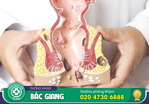 Kiểm tra hậu môn - Phát hiện sớm các bệnh liên quan tới trực tràng hậu môn