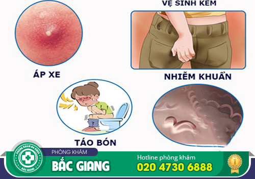 Nguyên nhân bệnh mạch lươn - Triệu chứng và phương pháp hỗ trợ điều trị