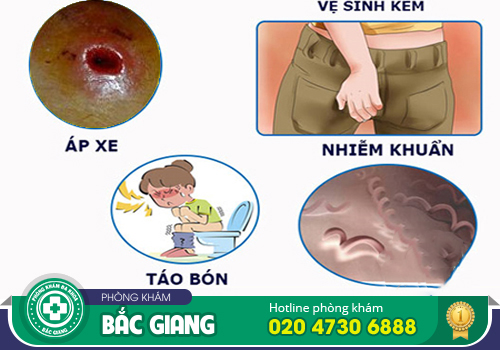Nhọt mạch lươn - Nguyên nhân, tác hại và cách điều trị