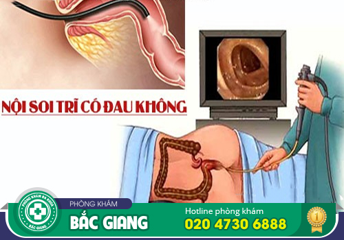 Nội soi trĩ không đau được thực hiện như thế nào?