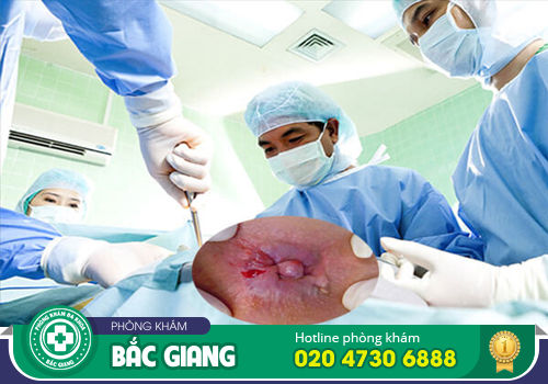 Nội soi trĩ không đau được thực hiện như thế nào?