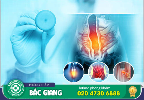 Nội soi trĩ không đau được thực hiện như thế nào?