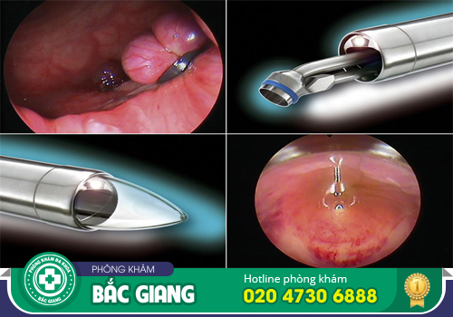 Nội soi trực tràng có đau không? Khi nào cần thực hiện?