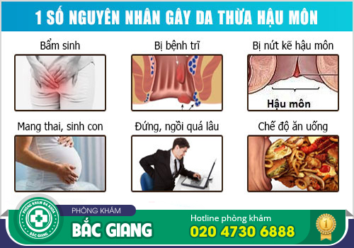 Thịt thừa ở mông phải làm sao? Nguyên nhân và cách chữa trị