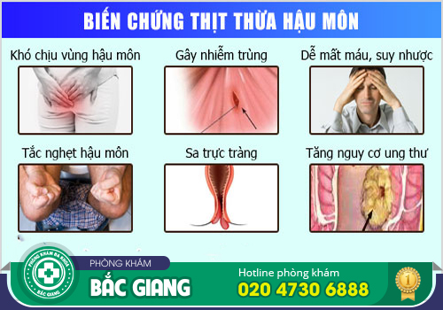 Có cục thịt dư hậu môn có phải bệnh trĩ không?