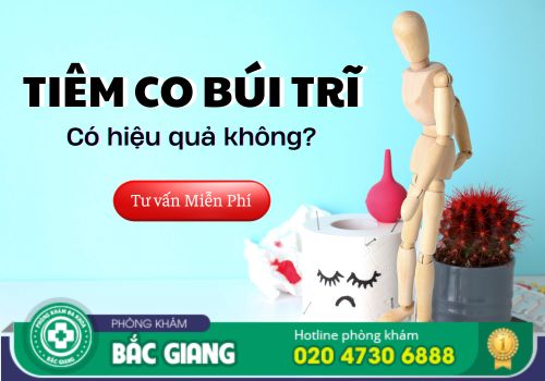 Thủ thuật tiêm co búi trĩ có hiệu quả không?