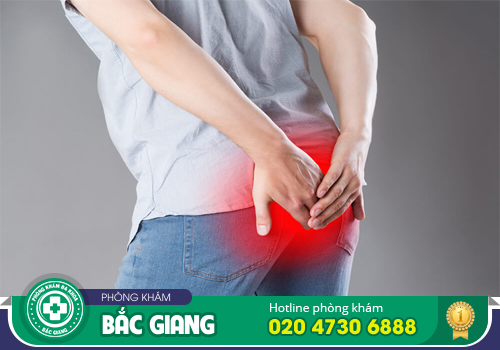 Viêm hậu môn không đơn giản là viêm nhiễm thông thường